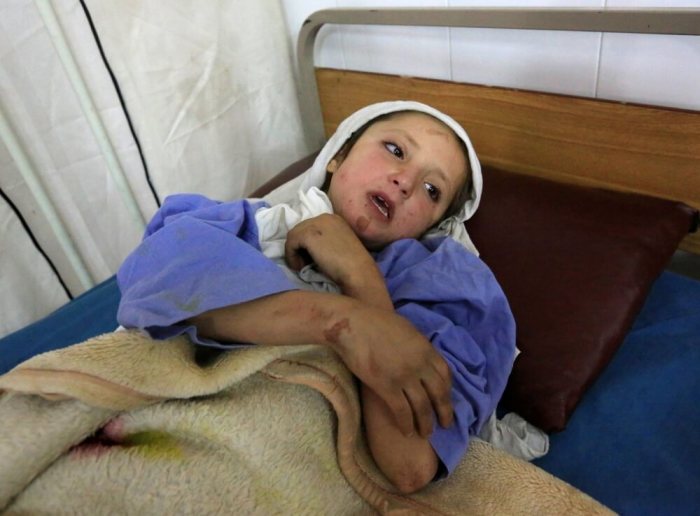 An Afghan girl wounded in an airstrike receives treatment at a hospital in Jalalabad, Afghanistan, October 28, 2016.