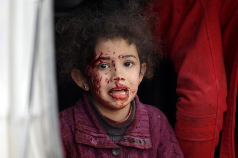 An injured girl reacts after a car bomb explosion in Jub al Barazi east of the northern Syrian town of al-Bab, Syria, January 15, 2017.