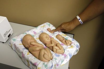 Executive Director of Alternatives Pregnancy Center Janet Lyons points to a plastic replica of a fetus at twelve weeks which is used to show women who come into the center to find out if they are pregnant and what the stage of growth looks like, in Waterloo, Iowa, July 6, 2011.