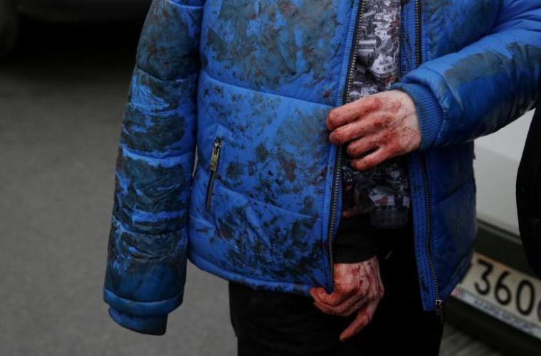 An iniured person walks outside Sennaya Ploshchad metro station in St. Petersburg, Russia, April 3, 2017.