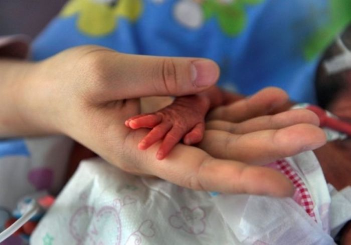 Baby born premature seen in this undated photo.