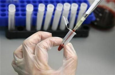 Credit : A laboratory technician examines blood samples for HIV/AIDS in a public hospital in Valparaiso city, about 75 miles (120 km) northwest of Santiago, November 14, 2008.