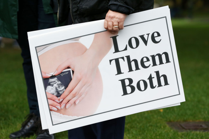 A pro-life supporter holds a sign during a pro-life, anti-abortion rally at Parliament in Wellington, New Zealand, on May 28, 2019.