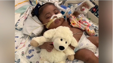 Tinslee Lewis, a 9-month-old baby girl at Cook Children's Medical Center in Fort Worth, Texas. 