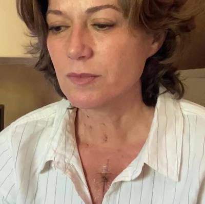 Amy Grant share photos post-heart surgery, June 15, 2020