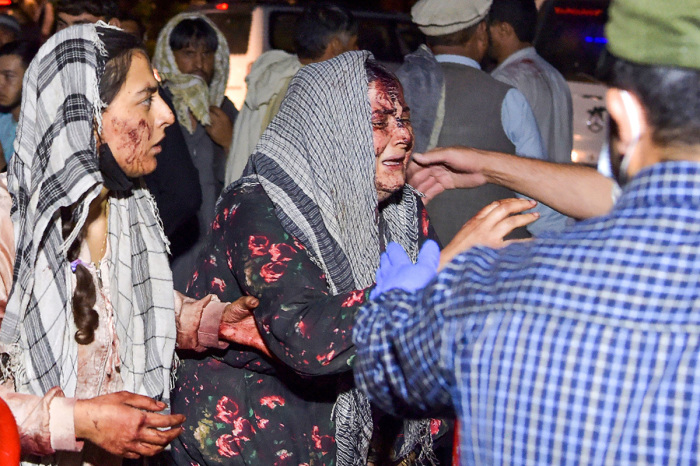 Wounded women arrive at a hospital for treatment after two blasts, which killed at least 11 and wounded at least 60, outside the airport in Kabul on August 26, 2021. The explosions came after warnings of a possible attack carried about by ISIS-Khorasan (ISIS-K), the Afghan branch of ISIS, on crowds trying to flee Afghanistan before the Biden administration's Aug. 31 deadline. 