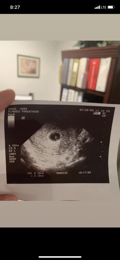 Dora Esparza's sonogram from Planned Parenthood.