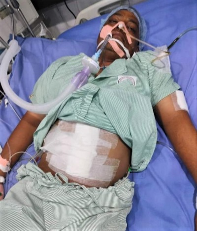 Pastor and taxi driver Sukhdev Mark lays in a hospital bed after being attacked in Haryana state, India on Sept. 15, 2022. 