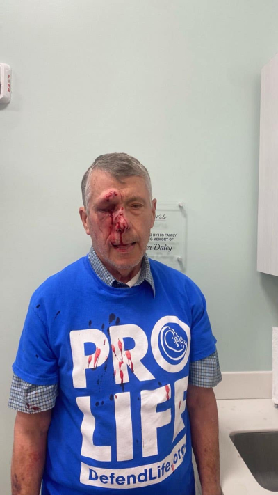 Pro-life activist Mark Crosby was assaulted outside a Planned Parenthood in Baltimore, Maryland, May 26, 2023.