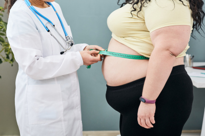 Obesity, unhealthy weight. Nutritionist inspecting a woman's waist using a meter tape to prescribe a weight loss diet. 