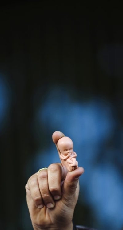 A woman displays a a plastic fetus during a march against a bill to ease restrictions on abortion, in Madrid, Saturday, Oct. 17, 2009. The protest was called to denounce a bill that would allow unrestricted abortion at up to 14 weeks of pregnancy and let girls aged 16 and 17 have abortions without parental consent, a vivid and emotional show of how the issue remains sensitive two decades after abortion was legalized in this traditionally Roman Catholic country.