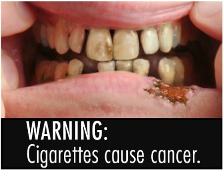 'Cigarettes cause cancer'