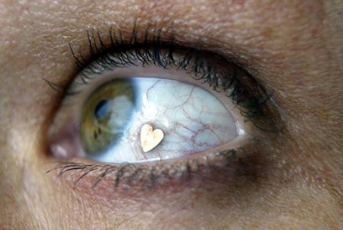 Deborah Boer models the 'Jewel Eye' in her hometown of Driebergen, the Netherlands in 2004. The surgical eyeball jewelry implant fad made its way to New York a few weeks ago.