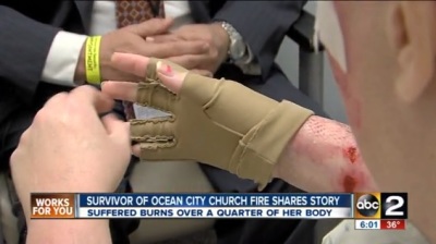 Burn victim Dana Truitt suffered third-degree burns from arson incident on November 26, 2013.