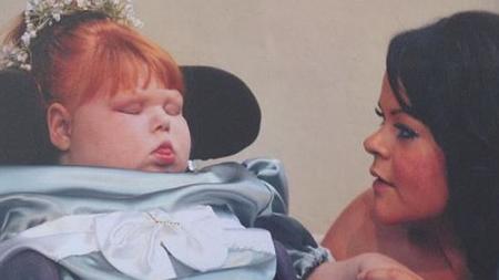 Charlotte Fitzmaurice Wise (right) is tending to her daughter, Nancy Fitzmaurice (left). Fitzmaurice Wise petition the U.K. High Court for authorization to euthanize her daughter, who was not suffering from any life-threatening illnesses and did not require life support to live.