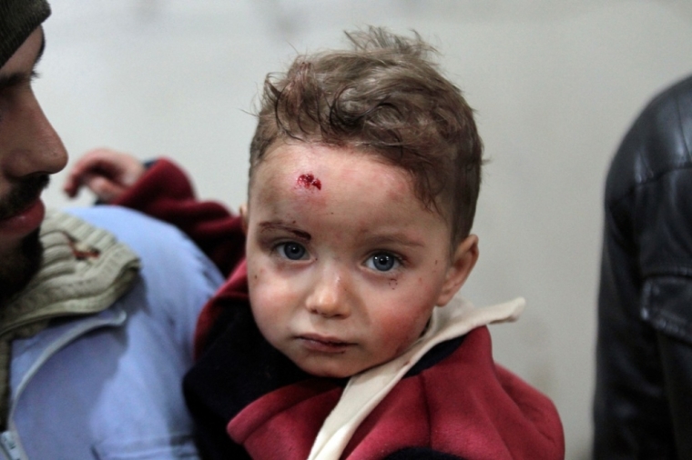 An injured child is seen in a field hospital after what activists said were air strikes by forces loyal to Syria's President Bashar al-Assad in Douma eastern Al-Ghouta, near Damascus January 25, 2015. Islamist fighters struck the Syrian capital with at least 38 rockets on Sunday, killing seven people, a monitoring group said, in one of heaviest attacks on Damascus in over a year. State media confirmed the attack and said at least four people were killed. It said the army was retaliating. The Saudi-backed Islam Army, based in the eastern Ghouta region near Damascus, had warned earlier that it would hit back against an air strike last week in Ghouta in which more than 40 people were killed.