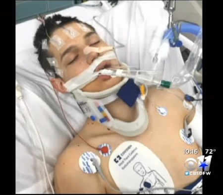 Zack Clements, 17, of Brownwood, Texas, receiving hospital treatment in May 2015.