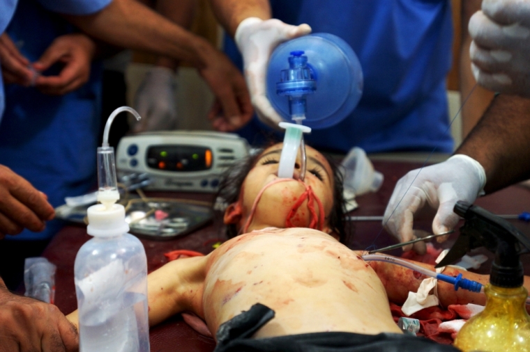 An injured girl receives treatment at a hospital, after what activists said were barrel bombs dropped over Dael city in Deraa countryside, Syria July 21, 2015.