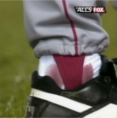 Curt Schilling's bloody sock from Game 6 of the 2004 American League Championship Series between the New York Yankees and the Boston Red Sox.