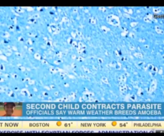 Brain Eating Amoeba: Boy, 4, Dies in Mississippi (VIDEO)