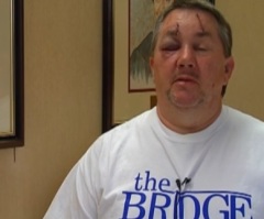 Prominent Atheist Blogger Appeals for $25,000 to Help Pastor Beaten by 'Militant Atheist'