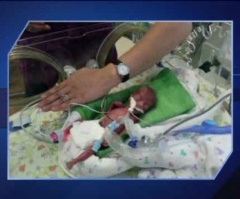 See the Baby Girl Who Wasn't Supposed to Live, But Became a Medical Miracle (VIDEO)