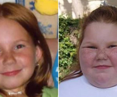 Strangers Raise Over $70,000 for Surgery to Save Morbidly Obese Girl (VIDEO)