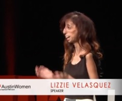 Once Called 'Ugliest Woman in the World', But True Beauty Is On the Inside and Lizzie Velasquez Knows it!