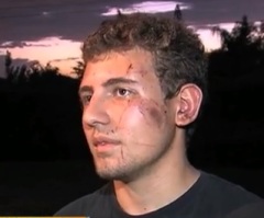 Fla. Teen Says 'Act of God' Helped Him Survive Vicious Attack on Face by Naked Man