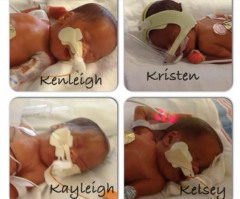 Mom Delivers Identical Triplets, Surprised With Undetected Fourth Baby (VIDEO)