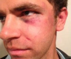 Deaf Man Sues Police After Being Tased, Abused While Heading to Bible Study (PHOTO)