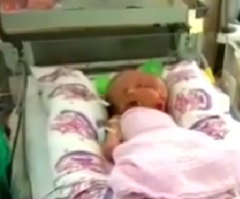 Conjoined Twins Who Share a Head Are Christened Hope and Faith, Continue to Surprise Doctors