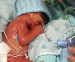 Baby That Was Clinically Pronounced Dead Was Revived by a Mother's Touch – A Miracle From God!