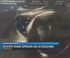 Jesus on the Cross Appears in Indiana Woman's Sonogram Photo?