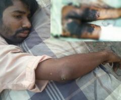 Christian Man Stripped, Burned With Hot Iron Rods for Befriending Muslim Woman