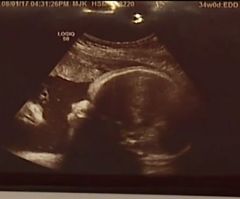 Sonogram Shows Jesus Watching Over Baby in Womb, Pennsylvania Couple Says