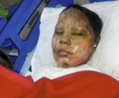 Christian Woman Set on Fire for Refusing Muslim Man's Marriage Proposal Dies in Pakistan