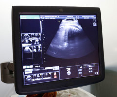 Kentucky Senate passes bill banning abortion when baby's heartbeat first detected