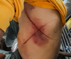 Venezuelan Christians forced to eat pages of the Bible, have 'crosses' etched into their bodies