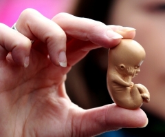 How does science support the pro-life cause? An apologist answers