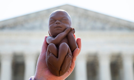 Human rights must not be twisted to include abortion