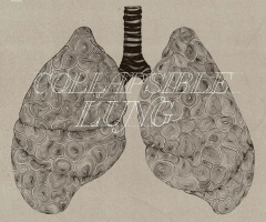 Relient K 'Collapsible Lung' to Release July 2